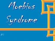 Moebius Syndrome